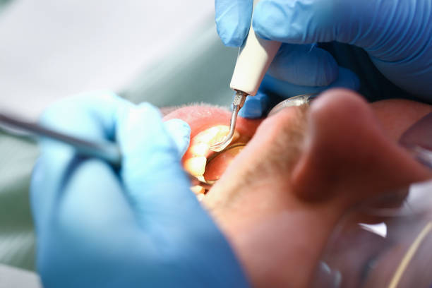 Best Walk-In Emergency Dentist in Crosby, ND
