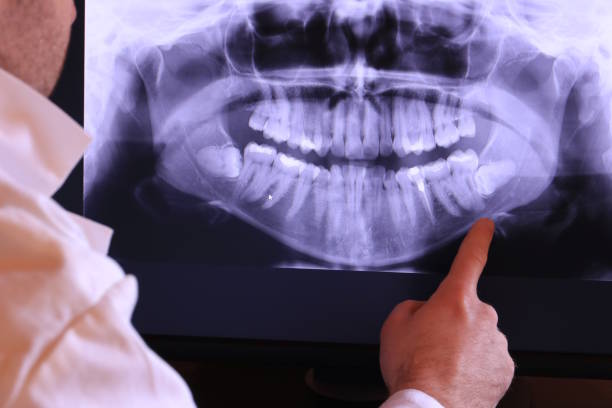 Best Emergency Treatment for Toothache in Crosby, ND