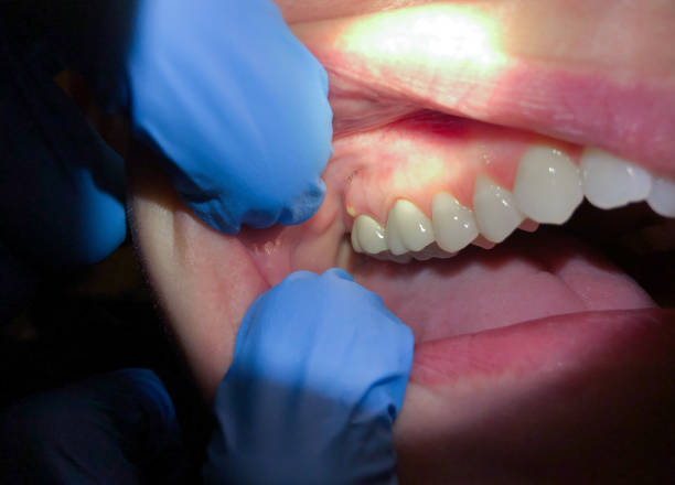 Best Emergency Treatment for Toothache in Crosby, ND