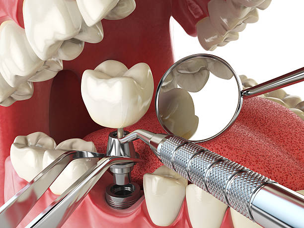 Best Same-Day Emergency Dentist in Crosby, ND