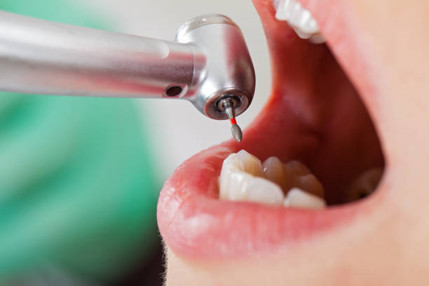Best Pediatric Emergency Dentist in Crosby, ND